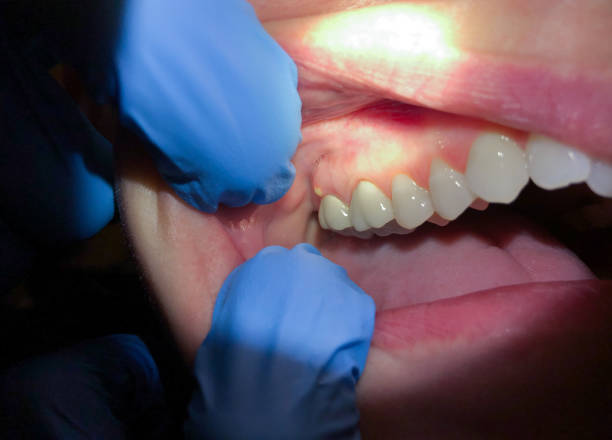 Best Emergency Treatment for Jaw Pain or Injury in Bayonne, NJ