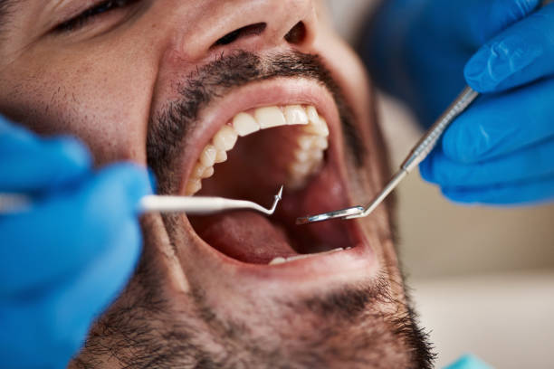 Best Emergency Treatment for Oral Infections in Bayonne, NJ